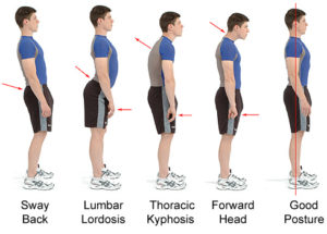Upright posture